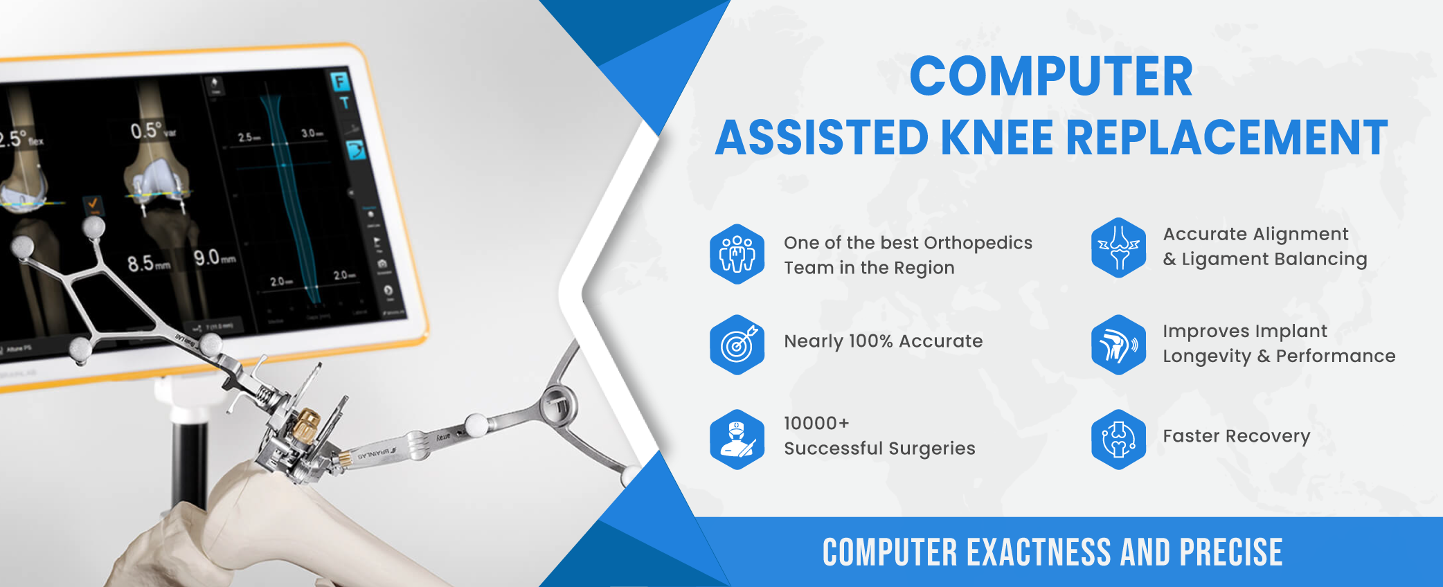 Computer Assisted Knee Replacement in Jaipur, India