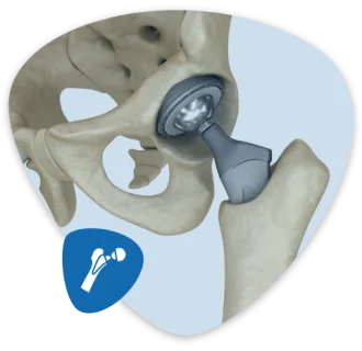 Best Hip Replacement Doctor in Jaipur, India