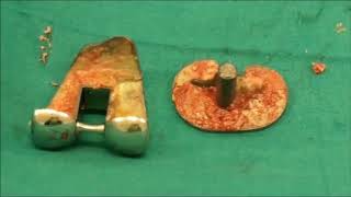Management of periprosthetic joint infection and making a knee spacer