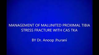 Management of proximal tibia stress fracture with CAS TKA by Dr. Anoop Jhurani